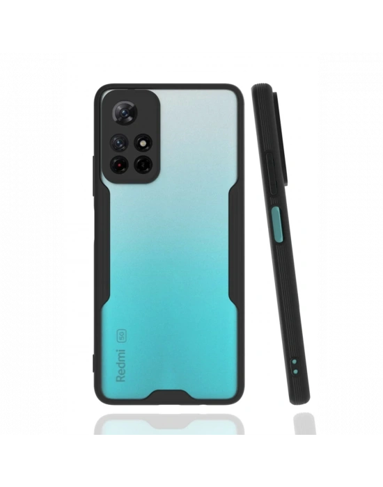 Newface Xiaomi Redmi Note 11T Kılıf Platin Silikon - Siyah