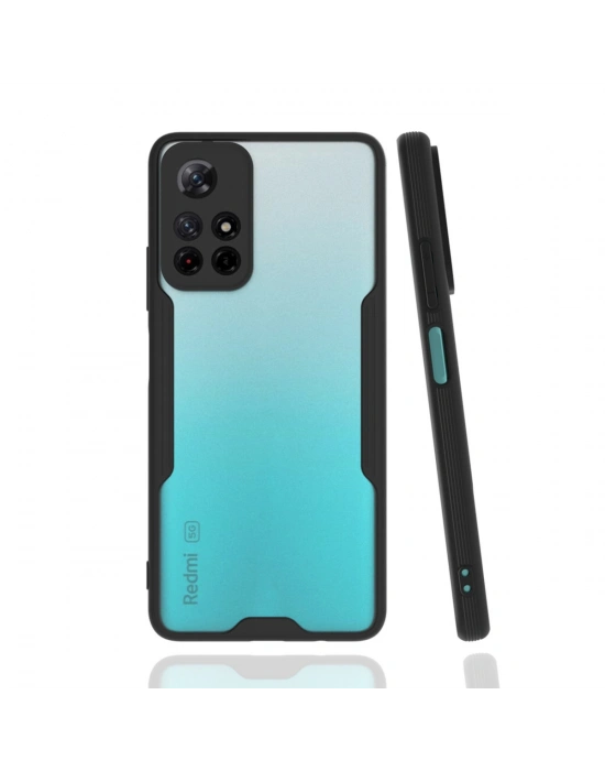 Newface Xiaomi Redmi Note 11T Kılıf Platin Silikon - Siyah