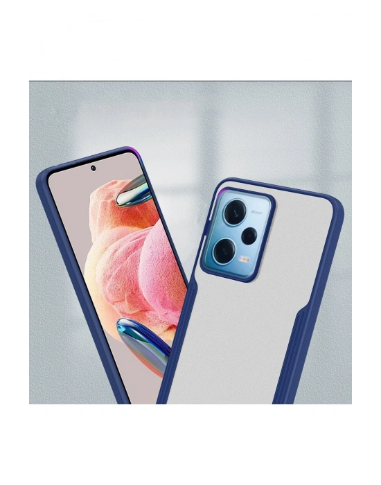 Newface Xiaomi Redmi Note 12 5G Kılıf Platin Silikon - Siyah