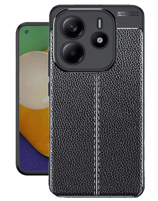 Newface Xiaomi Redmi Note 14 4G Kılıf Auto Focus Kapak - Siyah