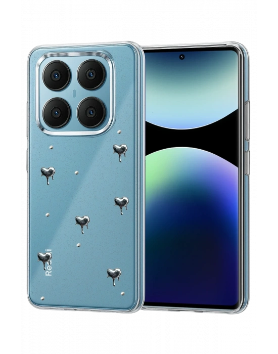 Newface Xiaomi Redmi Note 14 Pro 4G Fiyonk Desenli Kapak - Desen 3