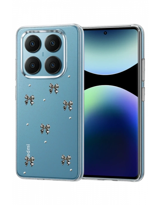 Newface Xiaomi Redmi Note 14 Pro 4G Fiyonk Desenli Kapak - Desen 5