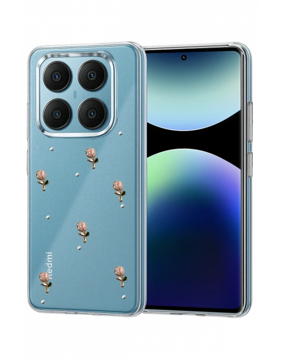 Newface Xiaomi Redmi Note 14 Pro 4G Fiyonk Desenli Kapak - Desen 6