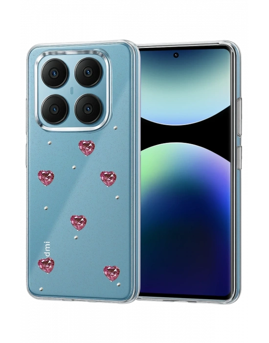 Newface Xiaomi Redmi Note 14 Pro 4G Fiyonk Desenli Kapak - Desen 7