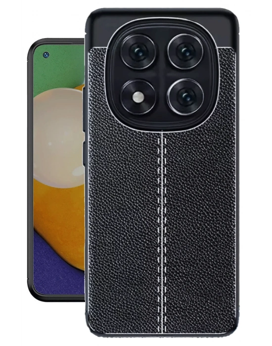 Newface Xiaomi Redmi Note 14 Pro 4G Kılıf Auto Focus Kapak - Siyah