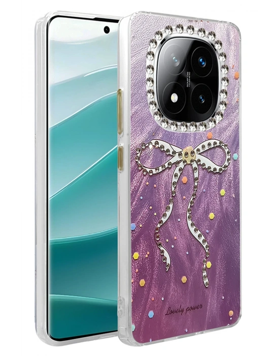 Newface Xiaomi Redmi Note 14 Pro 4G Kılıf Blade Aynalı Desenli Kapak - Desen 1