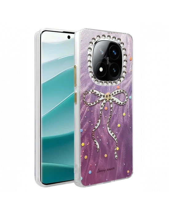 Newface Xiaomi Redmi Note 14 Pro 4G Kılıf Blade Aynalı Desenli Kapak - Desen 1