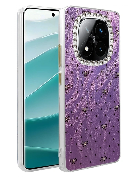 Newface Xiaomi Redmi Note 14 Pro 5G Kılıf Blade Aynalı Desenli Kapak - Desen 2