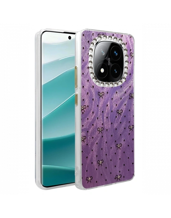 Newface Xiaomi Redmi Note 14 Pro 5G Kılıf Blade Aynalı Desenli Kapak - Desen 2