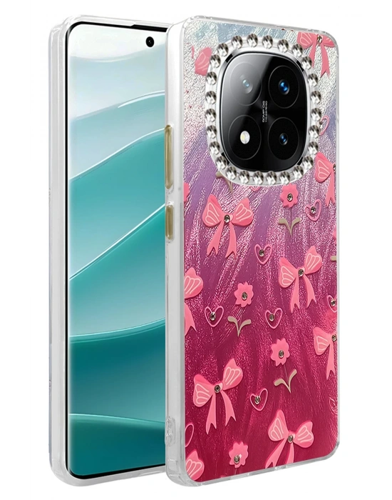 Newface Xiaomi Redmi Note 14 Pro 5G Kılıf Blade Aynalı Desenli Kapak - Desen 3