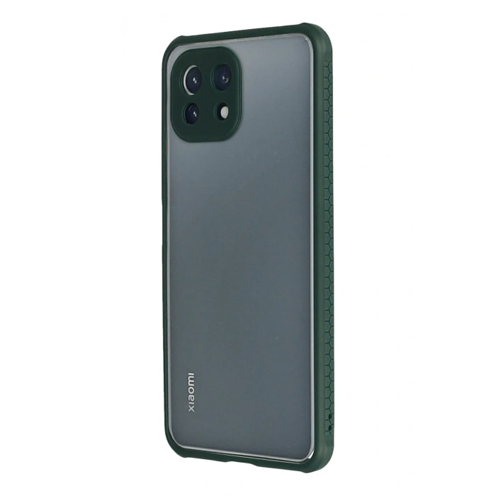 Newface Xiaomi Mİ 11 Lite Kılıf Miami Şeffaf Silikon - Koyu Yeşil