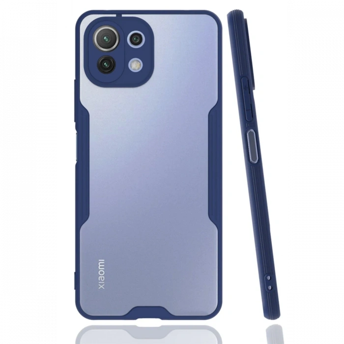 Newface Xiaomi Mİ 11 Lite Kılıf Platin Silikon - Lacivert