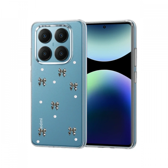 Newface Xiaomi Redmi Note 14 Pro 4G Fiyonk Desenli Kapak - Desen 8