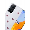 Newface Xiaomi Redmi Note 11 Pro Fiyonk Desenli Kapak - Desen 3