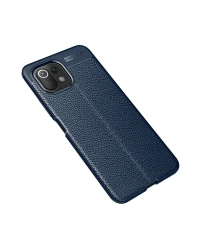 Newface Xiaomi Mİ 11 Lite Kılıf Auto Focus Kapak - Lacivert