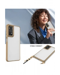 Newface Xiaomi Redmi Note 11 Pro Kılıf Penta Silikon Kılıf - Çöl Titanyum