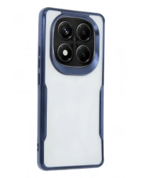 Newface Xiaomi Redmi Note 14 Pro 4G Kılıf Boyi Silikon Kapak - Lacivert