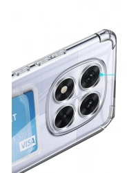 Newface Xiaomi Redmi Note 14 Pro 5G Kılıf Kart Şeffaf Silikon - Şeffaf