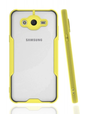 Newface Samsung Galaxy J7 Kılıf Platin Silikon - Sarı