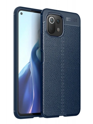 Newface Xiaomi Mİ 11 Lite Kılıf Auto Focus Kapak - Lacivert