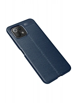 Newface Xiaomi Mİ 11 Lite Kılıf Auto Focus Kapak - Lacivert