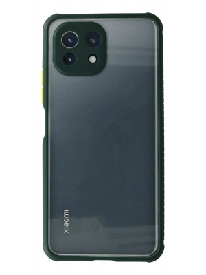 Newface Xiaomi Mİ 11 Lite Kılıf Miami Şeffaf Silikon - Koyu Yeşil