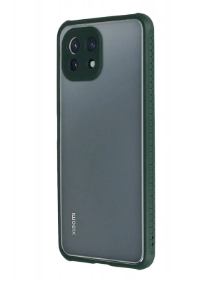 Newface Xiaomi Mİ 11 Lite Kılıf Miami Şeffaf Silikon - Koyu Yeşil