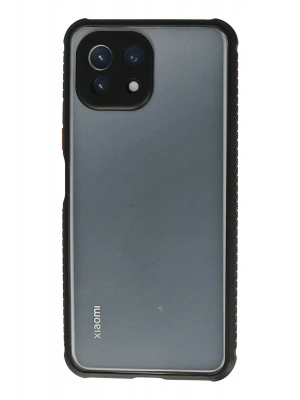 Newface Xiaomi Mİ 11 Lite Kılıf Miami Şeffaf Silikon - Siyah
