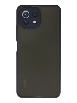 Newface Xiaomi Mİ 11 Lite Kılıf Montreal Silikon Kapak - Lacivert