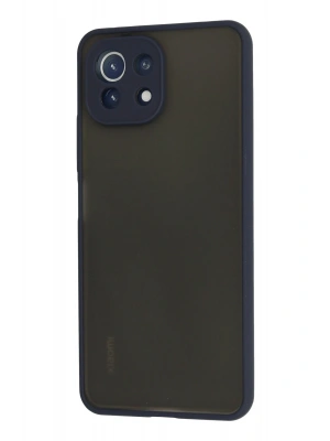 Newface Xiaomi Mİ 11 Lite Kılıf Montreal Silikon Kapak - Lacivert