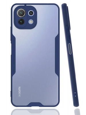 Newface Xiaomi Mİ 11 Lite Kılıf Platin Silikon - Lacivert
