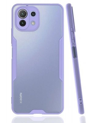 Newface Xiaomi Mİ 11 Lite Kılıf Platin Silikon - Lila