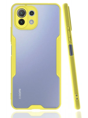 Newface Xiaomi Mİ 11 Lite Kılıf Platin Silikon - Sarı