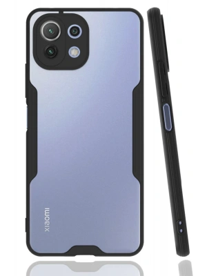 Newface Xiaomi Mİ 11 Lite Kılıf Platin Silikon - Siyah