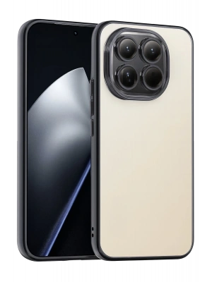 Newface Xiaomi Mi 15 Razer Lensli Silikon - Siyah