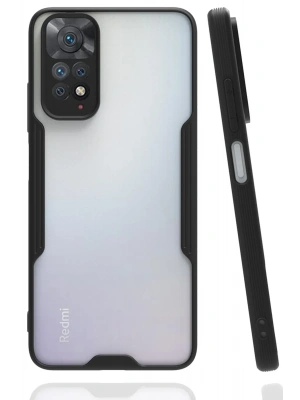Newface Xiaomi Redmi Note 11 Kılıf Platin Silikon - Siyah