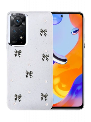 Newface Xiaomi Redmi Note 11 Pro Fiyonk Desenli Kapak - Desen 8