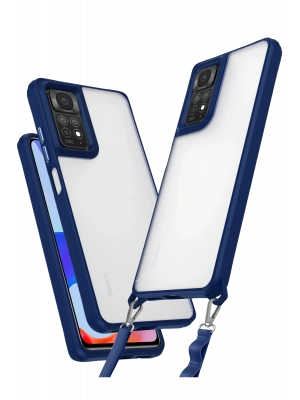 Newface Xiaomi Redmi Note 11 Pro Kılıf Penta Silikon Kılıf - Lacivert