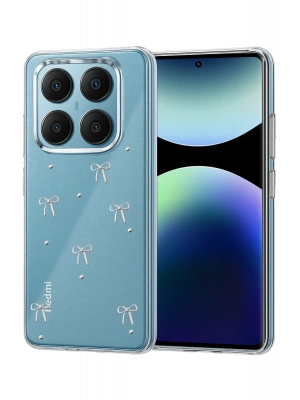 Newface Xiaomi Redmi Note 14 Pro 4G Fiyonk Desenli Kapak - Desen 1