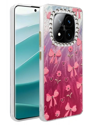 Newface Xiaomi Redmi Note 14 Pro 4G Kılıf Blade Aynalı Desenli Kapak - Desen 3