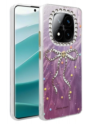 Newface Xiaomi Redmi Note 14 Pro 5G Kılıf Blade Aynalı Desenli Kapak - Desen 1