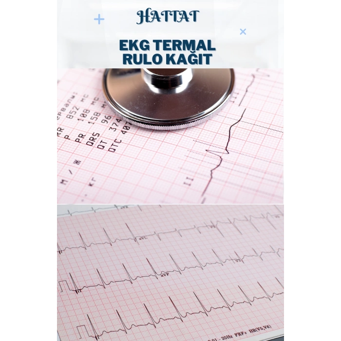 60 Adet Rulo Ekg Ecg 210mmx20metre Tam Metrajlı Yüksek Kaliteli Hassas Karelajlı Rulo Termal Kağıt