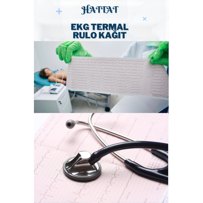 60 Adet Rulo Ekg Ecg 210mmx20metre Tam Metrajlı Yüksek Kaliteli Hassas Karelajlı Rulo Termal Kağıt