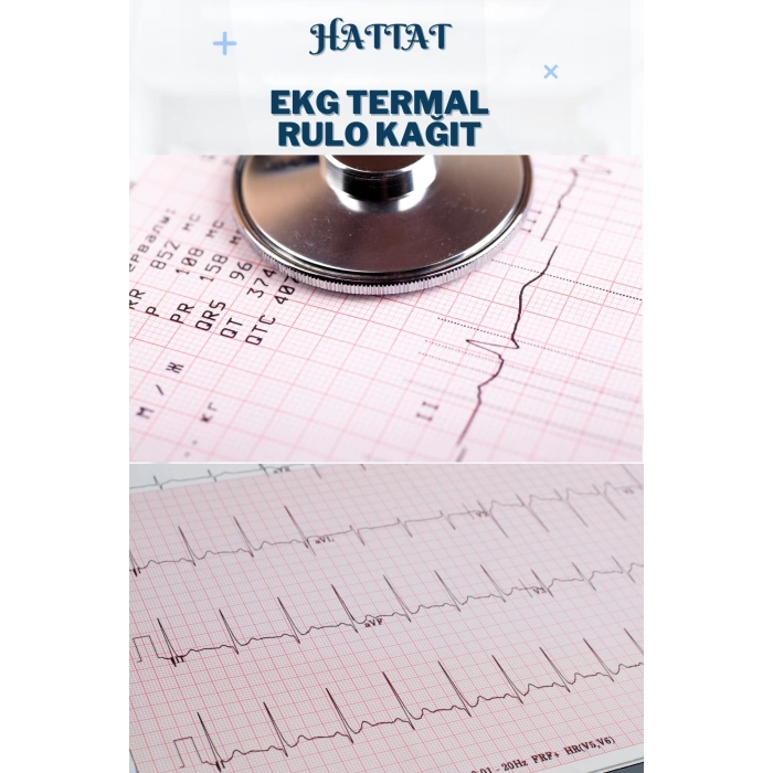 100 Adet Rulo Ekg Ecg 50mmx20metre Tam Metrajlı Yüksek Kaliteli Hassas Karelajlı Rulo Termal Kağıt