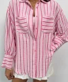ÇİZGİLİ GÖMLEK - Pembe