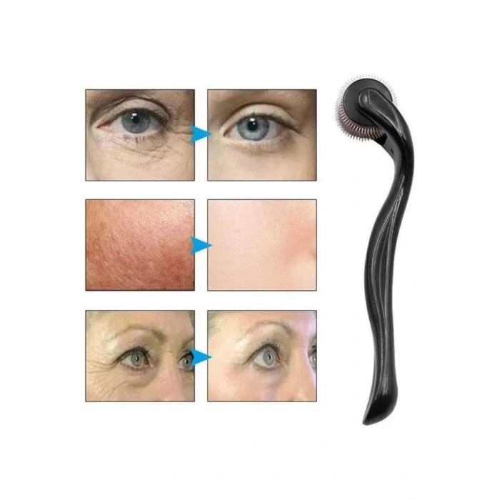 Dermaroller Titanyum 540 Iğneli 1 Mm Saç Kaş Sakal Serum Kullanıma Uygun
