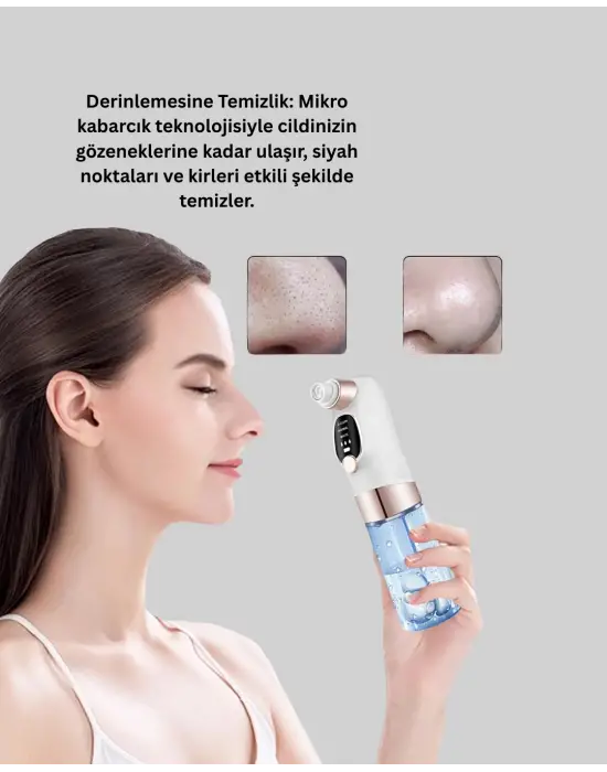 Çok Fonksiyonlu Cilt Bakım Cihazı – Siyah Nokta, Gözenek Ve Akne Temizleyici
