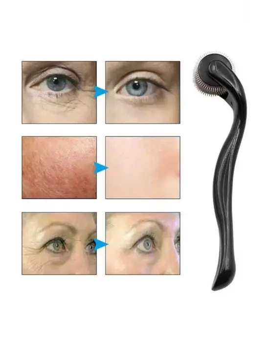 Dermaroller Titanyum 540 Iğneli 1 Mm Saç Kaş Sakal Serum Kullanıma Uygun