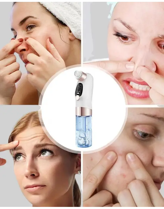 Elektrikli Siyah Nokta Sökücü – Derinlemesine Gözenek Temizleme Cihazı