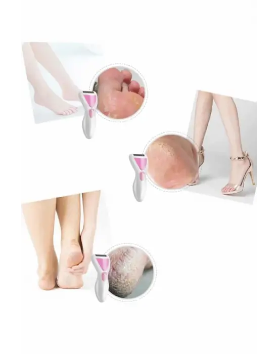 Epilatör Cihazı Epilasyon Aleti Çoklu Başlık Seçeneği Ayak Törpüsü
